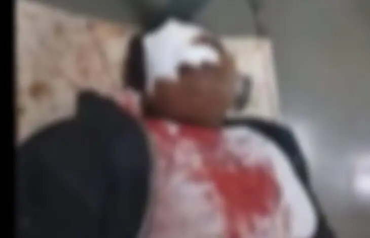 बार में सिर पर बोतल से हमला, 23 दिन बाद युवती की मौत